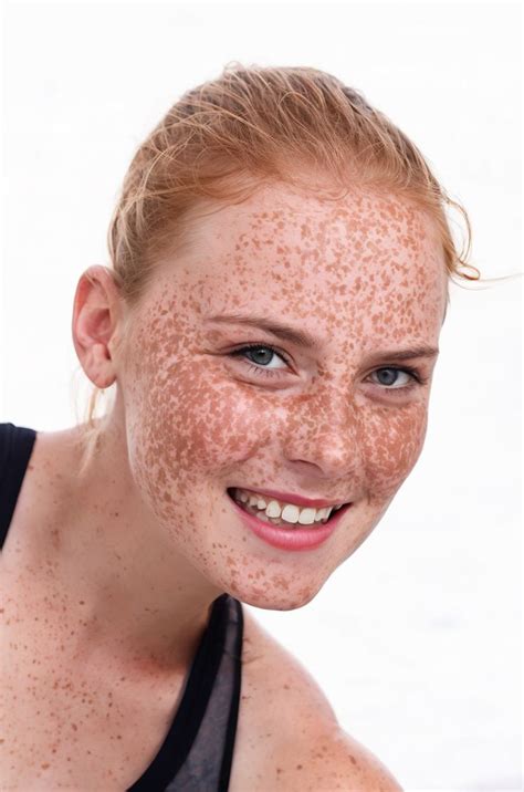Red Freckles Women With Freckles Beautiful Freckles Beautiful