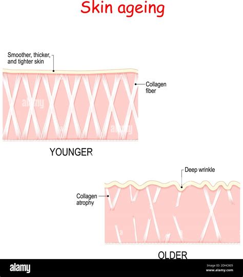 Visual Representation Of Skin Changes Over A Lifetime In Young Skin