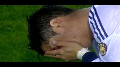 Ronaldo Eye Injury Youtube
