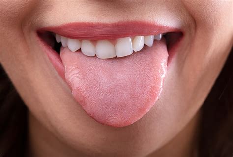 Home Remedies For Dry Mouth 10 Ways To Ease Symptoms Top 10 Home