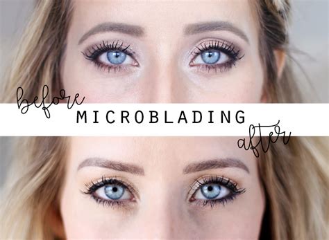 Get results from 6 search engines! The Truth About Microblading