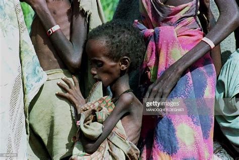 A Starving Somali Child Waits For Food At The Noolays Relief Camp In