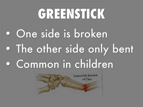 Bone Fractures by Katelynn Jones