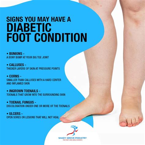 Signs You May Have A Diabetic Foot Condition Infographic