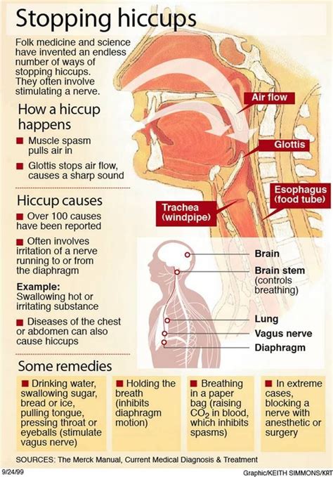 Hiccups The Causes And How To Cease Them Stopping Hiccups Folk Medicine And Science Have