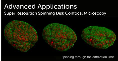 Super Resolution Spinning Disk Confocal Microscopy