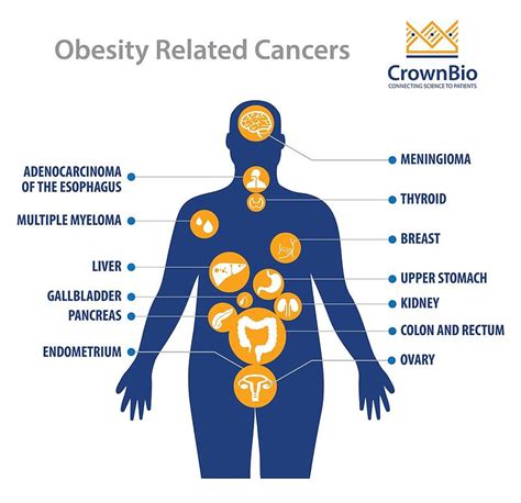 obesity cancer development and immunotherapy response