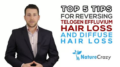 Hair loss (alopecia) can affect just your scalp or your entire body, and it can be temporary or permanent. Top 5 Tips for reversing Telogen Effluvium Hair Loss and ...