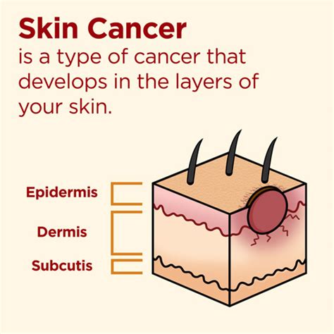 Skin Cancer Statistics Facts And You Healthline