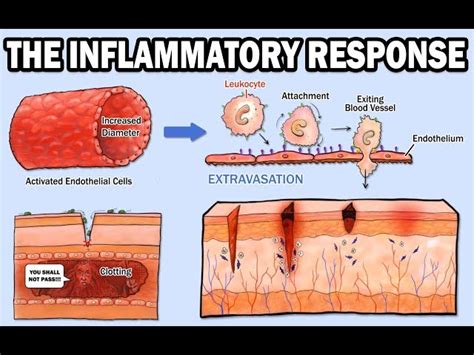 Inflammatory Videos Inflammatory Clips