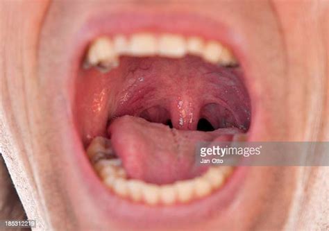 Uvula Photos And Premium High Res Pictures Getty Images