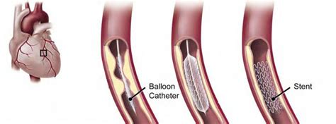 So when should i introduce baby's step 1. Stents don't work. | Step One Foods