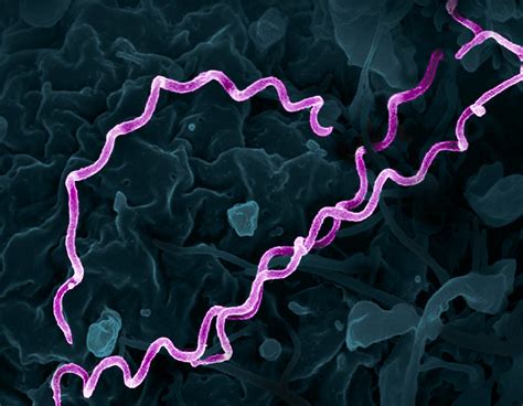 Treponema Pallidum Bacteria Syphilis Colorized Electron Flickr