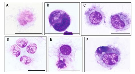 Microscopic Immages Of Myelo Monocytic Cells From The Peritoneal