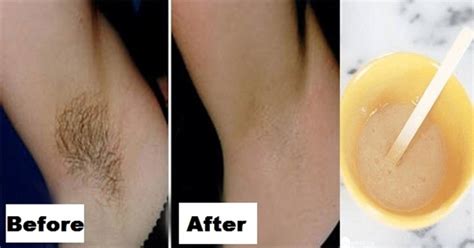 You Only Need 2 Ingredients And 2 Minutes To Get Rid Of Underarm Hair Forever