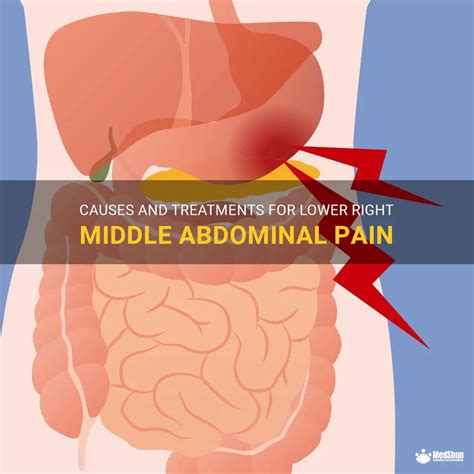 Causes And Treatments For Lower Right Middle Abdominal Pain Medshun