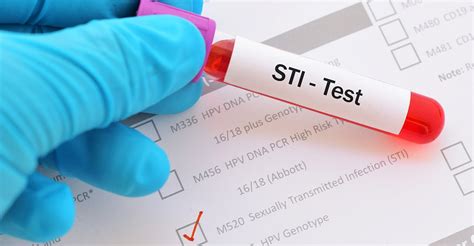 Sexually Transmitted Disease Definitions Symptoms And How To Prevent