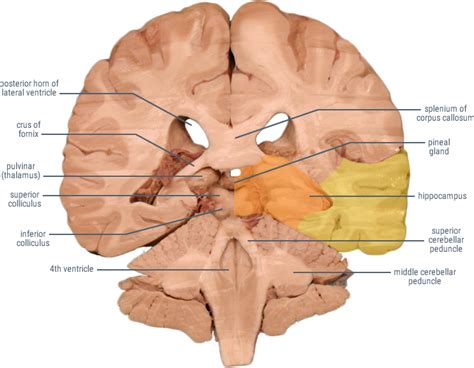 Posterior Cerebral Artery