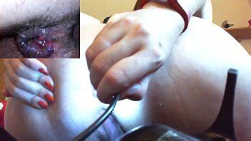 Hardcore Anal Session With A Medical Endoscope A Super Medical Fetish Video Xnxx Com