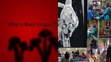 What Is Black Fungus 🤔😷 Youtube