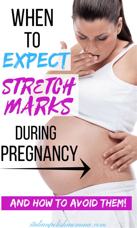 how to prevent stretch marks during pregnancy artofit