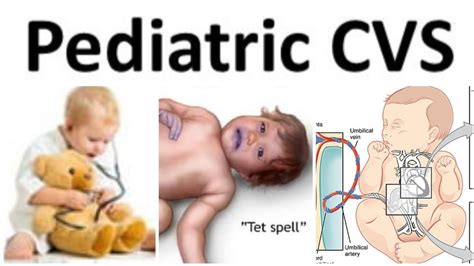 Cvs Paediatrics 8 Infective Endocarditis Youtube