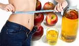 Photos of Can Vinegar Make You Lose Weight