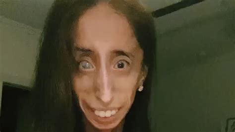 La Activista Lizzie Velasquez Dio Una Lección De Tolerancia A Los