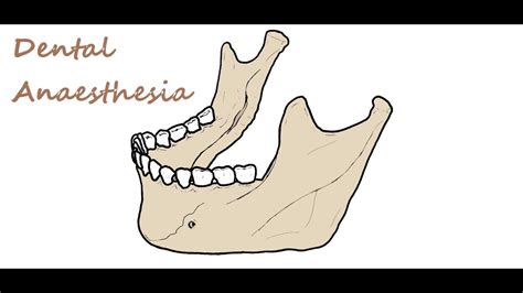 Dental Anaesthesia Maxillary And Mandibular Blocks Youtube