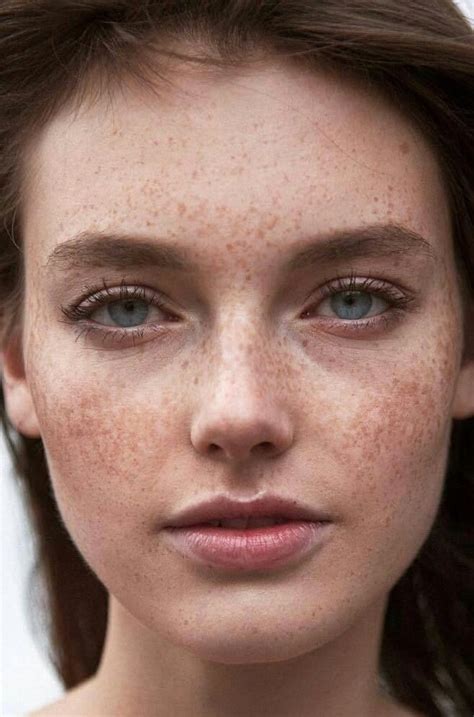 Pin By Lynn Kimbell On Freckles Are Beautiful Beautiful Freckles