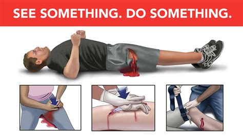 Uab News Uab Surgeons Explain Stop The Bleed Initiative And Why More Kits Are Needed