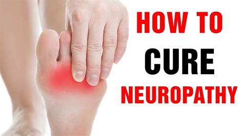 Top Home Remedies For Neuropathy Pain In Hands Legs And Feet Youtube