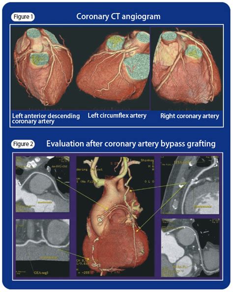 To Medicalstaff Division Of Coronary Diseases Cardiovascular