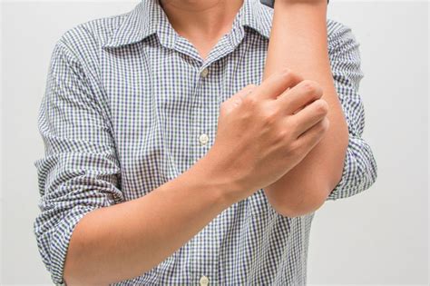 For Those Who Read 10 Warning Signs Of Eczema To