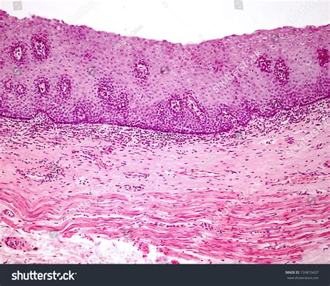 Stratified Squamous Epithelium Non Keratinized Esophagus