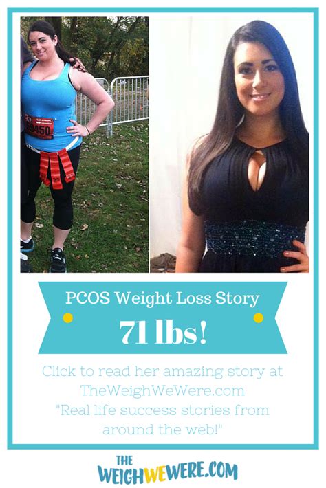 Pin On Pcos Weight Loss Stories