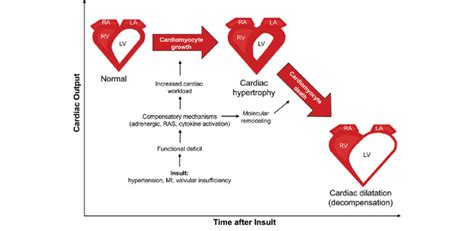 Development And Progression Of Decompensated Left Ventricular