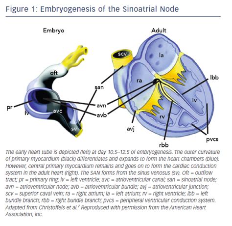 Figure 1 Embryogenesis Of The Sinoatrial Node Radcliffe Cardiology