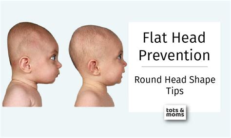 Tips To Prevent Flat Heads In Babies