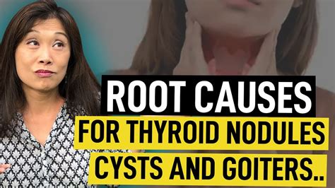 Maggie Yu Md Root Causes For Thyroid Nodules Cysts And Goiters