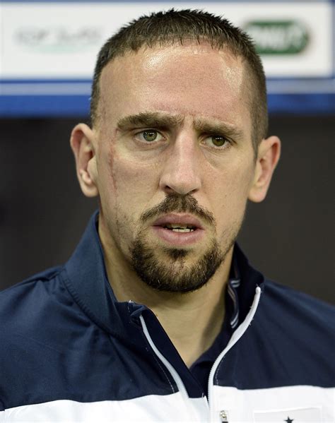 Ribery : How did Franck Ribery get his permanent scar?