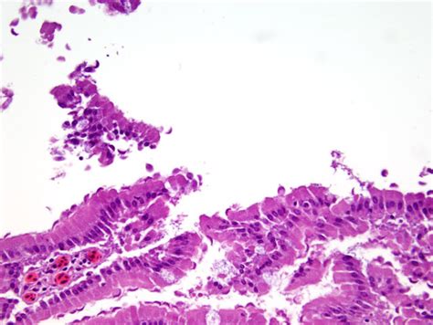 Giardia Colon Histology Giardia Duodenum Histopathology Giardiasis My
