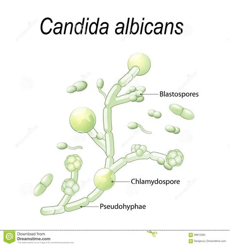 Illustration About Candida Albicans Is A Type Of Yeast Causes