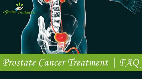Prostate Cancer Treatment Options [the Ones That Work]