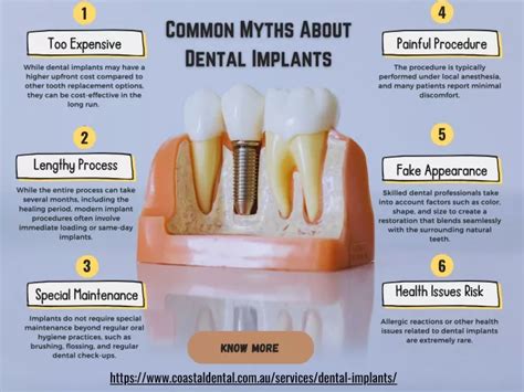 Ppt Common Myths About Dental Implants Powerpoint Presentation Free Download Id