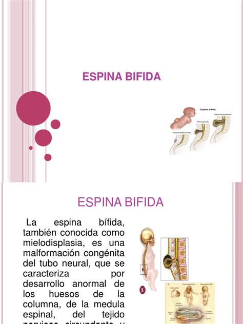 Espina Bifida Pdf Medicina Clinica Enfermedades Y Trastornos