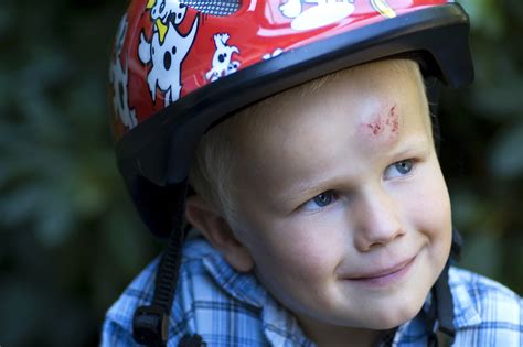 Accidentes Infantiles ¿cómo Actuar Ante Un Golpe En La Cabeza