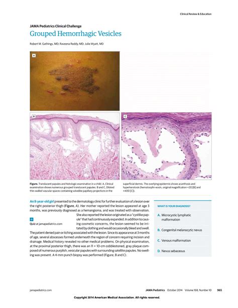 Grouped Hemorrhagic Vesicles Dermatology Jama Pediatrics Jama Network