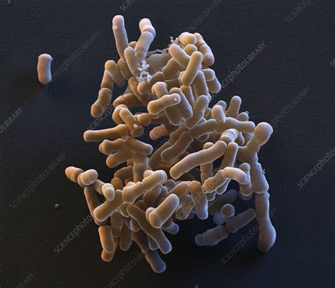 Bifidobacterium Bacteria Sem Stock Image C0290323 Science Photo