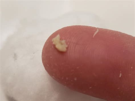 Got This Out Of My Back Smells Like Bad Cheese Rpopping